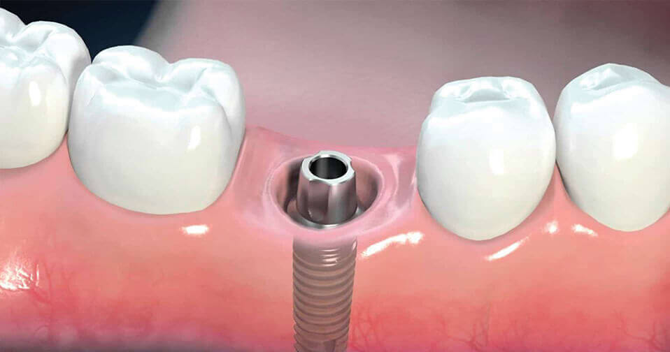 جراحه الفم وزراعه الاسنان